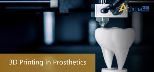 3D Printing In Prosthetics | 3D Printing Use Cases | 3D Printing ...